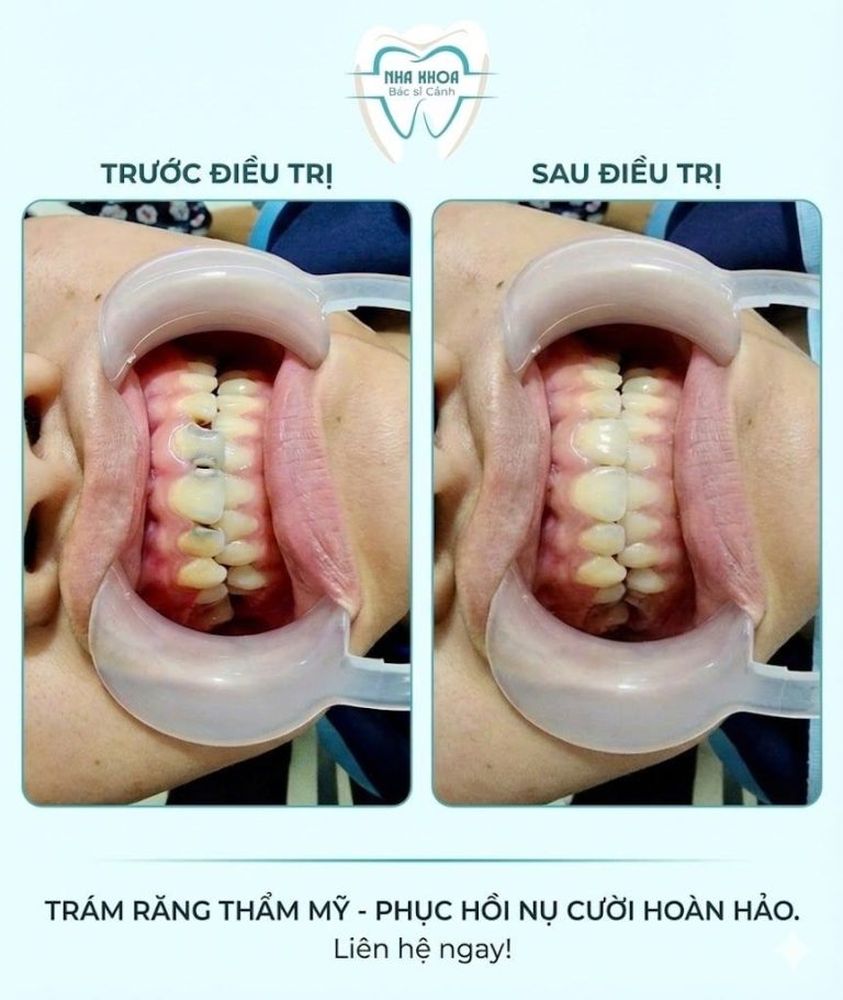 tram rang bs canh cainuoc 2